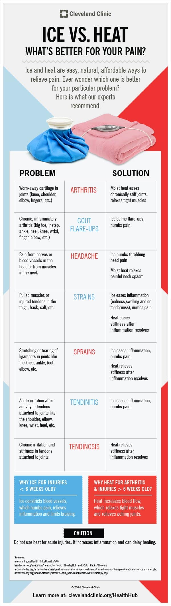 Ice vs Heat Therapy - Infographics